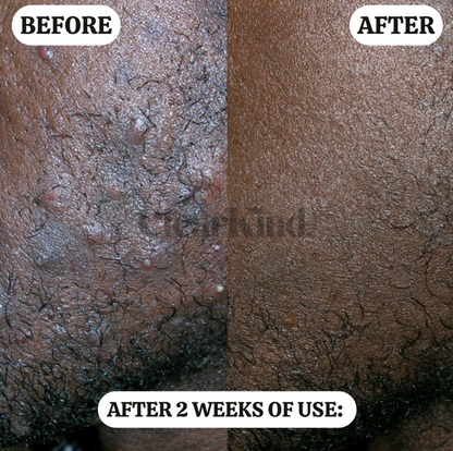 The Barrier Reset Formula